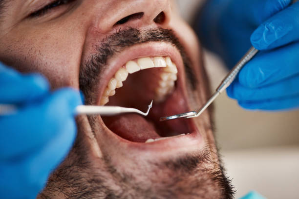Best Root Canal Emergency Dentist  in Liberty, NC